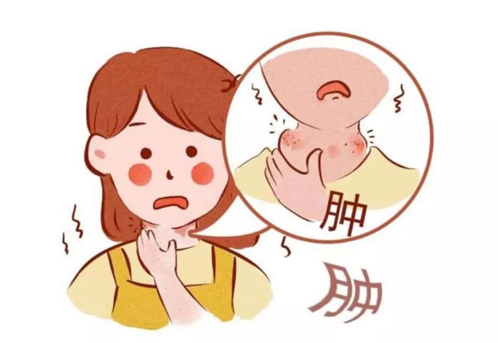 扁桃體發炎吃什么藥好得快？扁桃體發炎飲食禁忌有哪些？